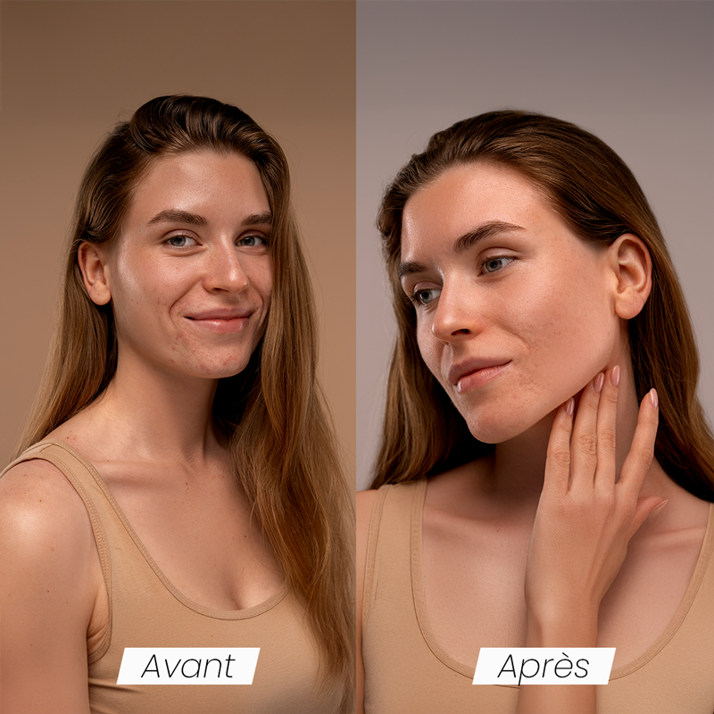 Efficacité SkynGlow